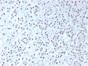 Recombinant WT1 Antibody / Rabbit Monoclonal