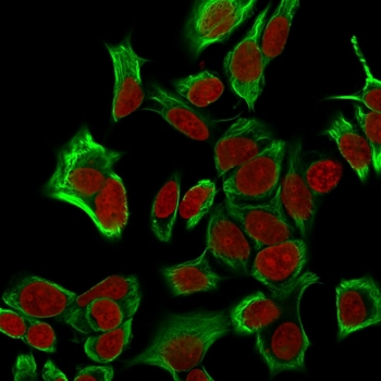 Recombinant EpCAM Antibody / Rabbit Monoclonal