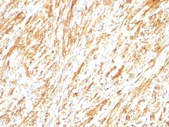 Glial Fibrillary Acidic Protein Antibody