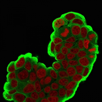HSP27 Antibody