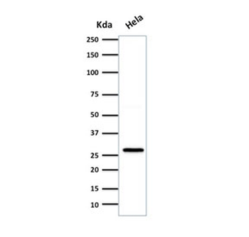 HSP27 Antibody