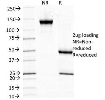 HSP27 Antibody