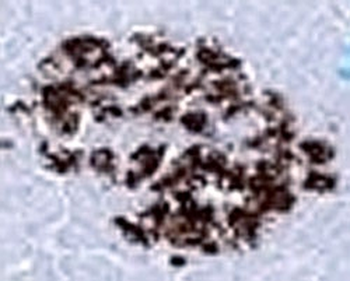 Insulin Antibody