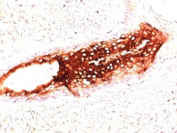 Cytokeratin 17 Antibody