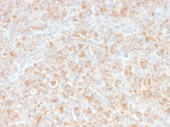 TNF-alpha Antibody