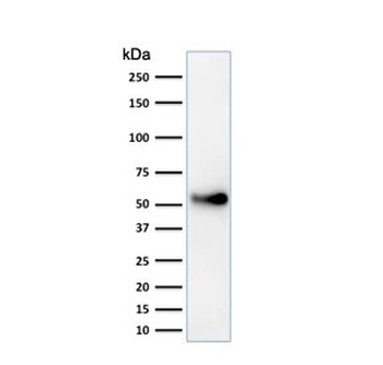 p53 Antibody