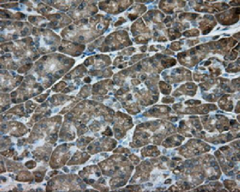 ACSBG1 Antibody