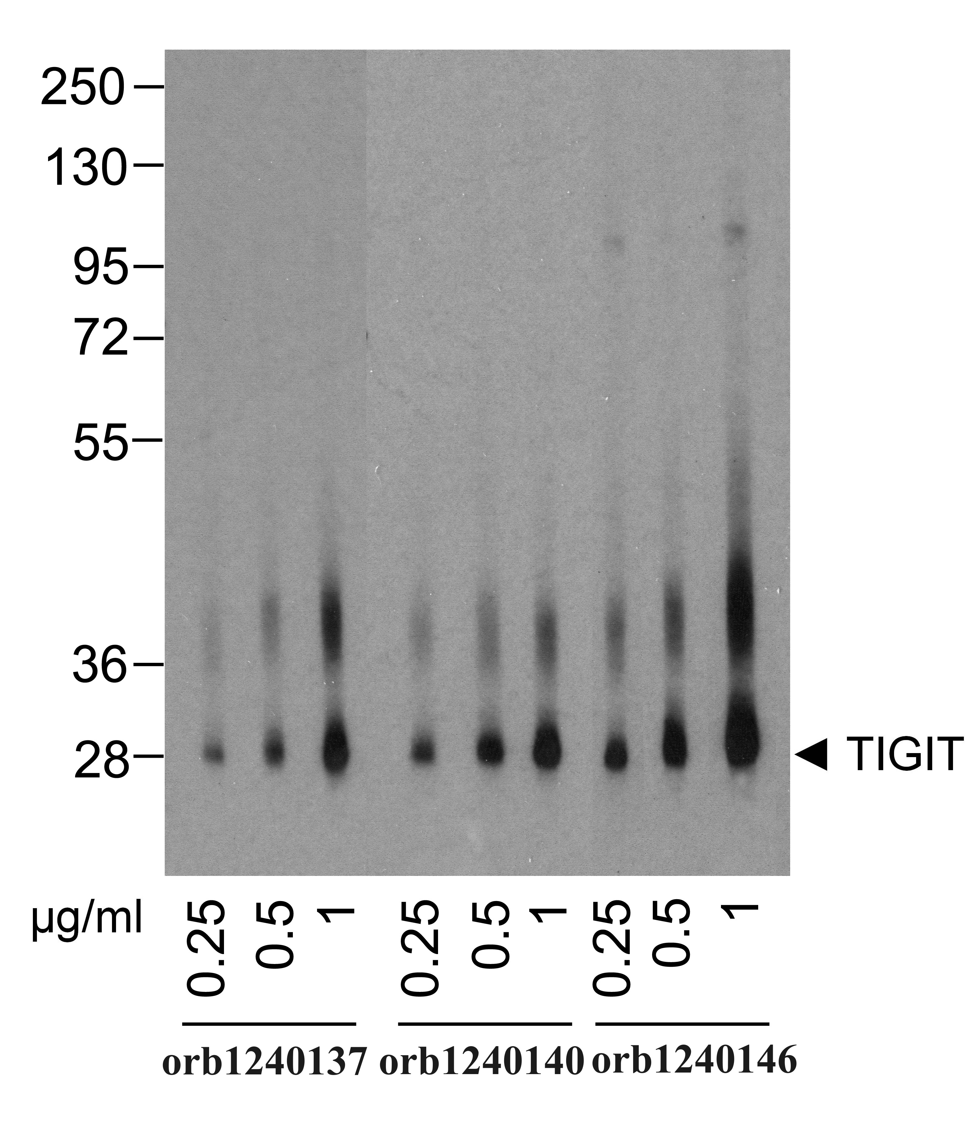TIGIT Detection Set (Risk Free)