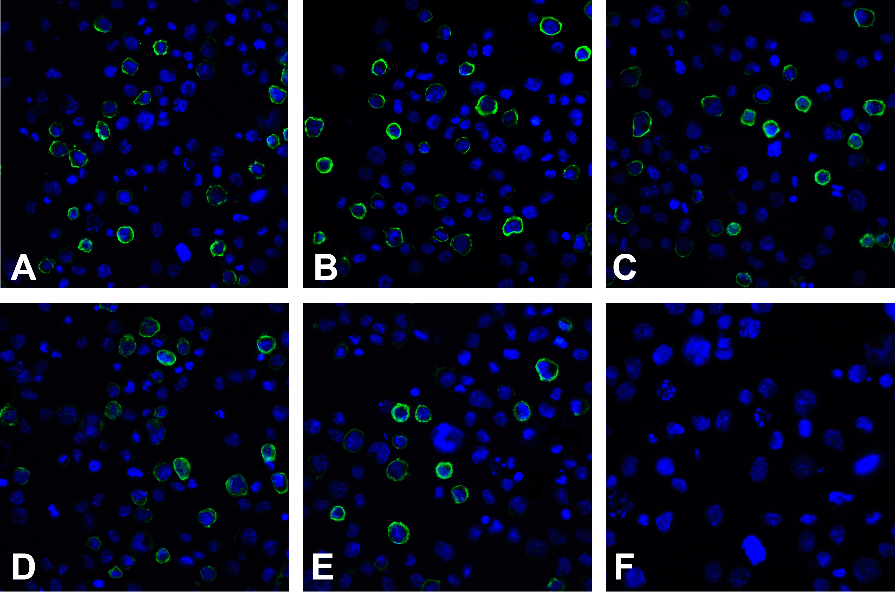 PDL2 Detection Set (Risk Free)