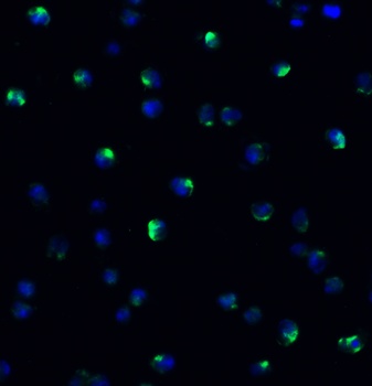 NCOA4 Antibody