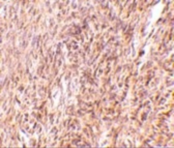 Trim30 Antibody
