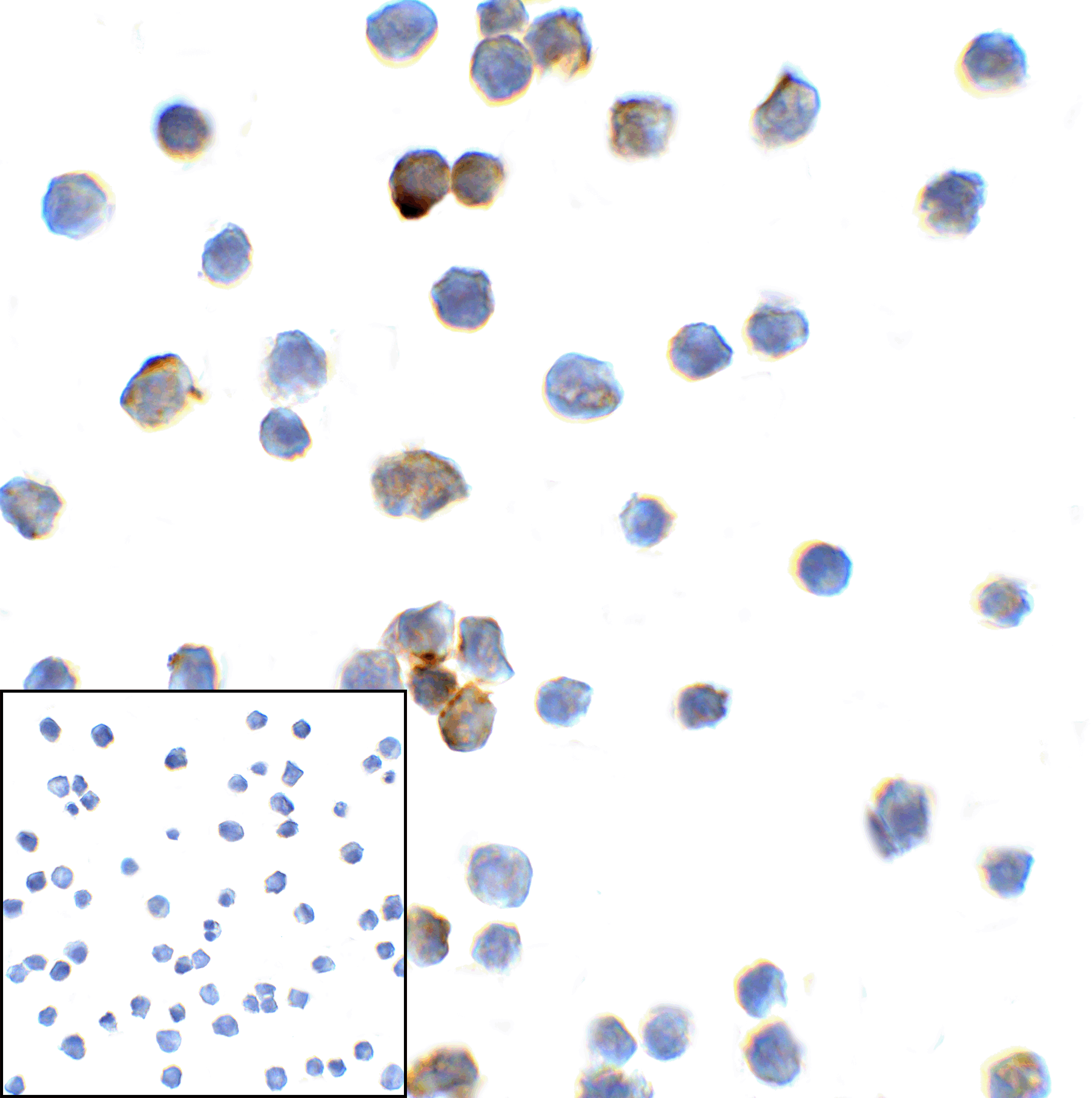 TMIGD2 Antibody