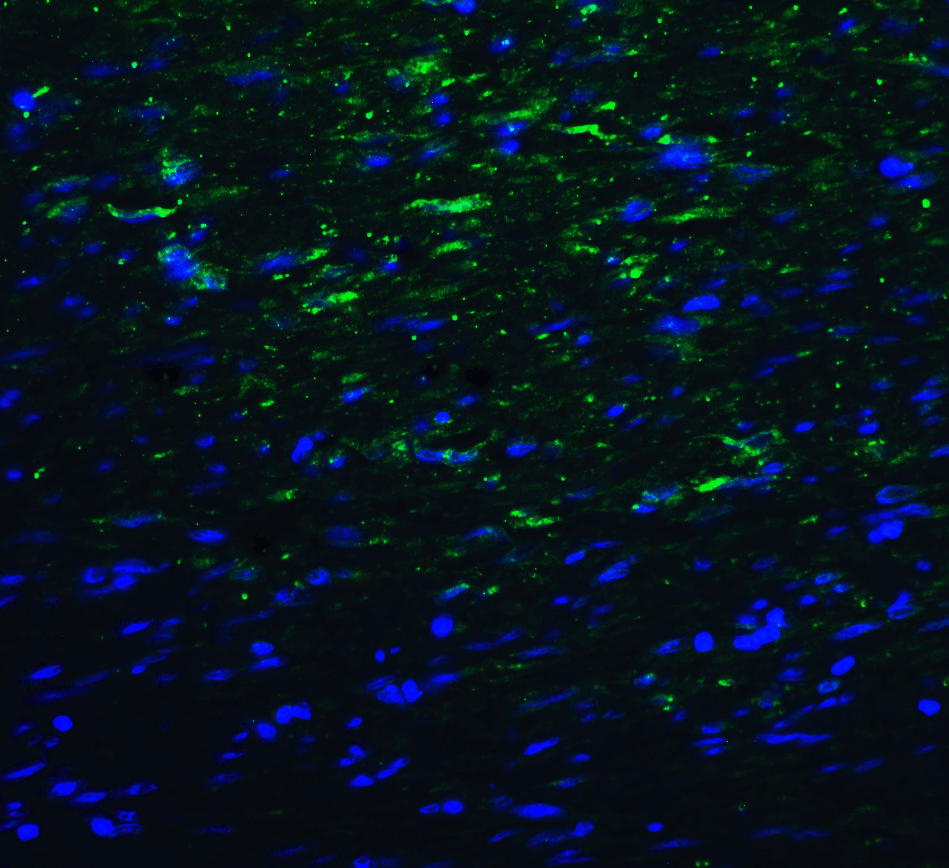 TMIGD2 Antibody