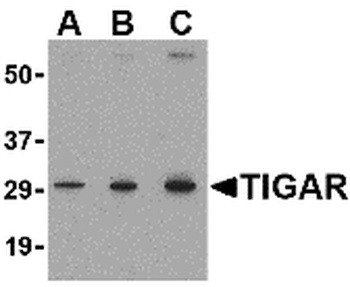 C12orf5 Antibody