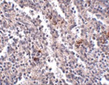 SYPL2 Antibody