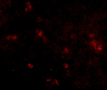 SYPL2 Antibody
