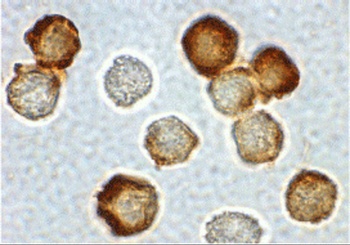 IRAK2 Antibody