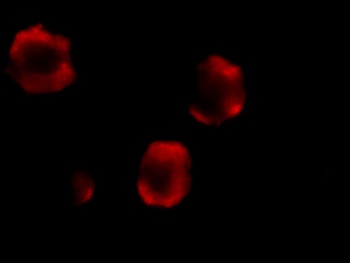 IRAK2 Antibody