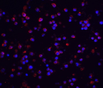 IRAK2 Antibody