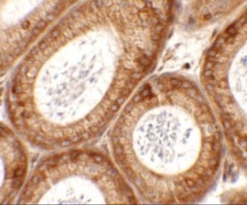 SPATA6 Antibody