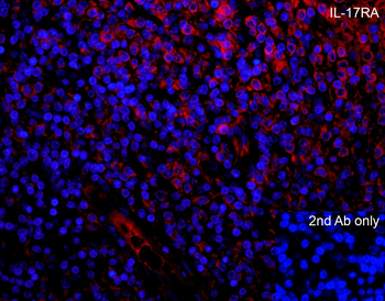 IL17RA Antibody