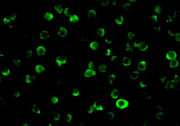 CFLAR Antibody