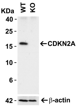 CDKN2A/p16INK4a Antibody