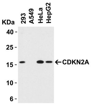 CDKN2A/p16INK4a Antibody