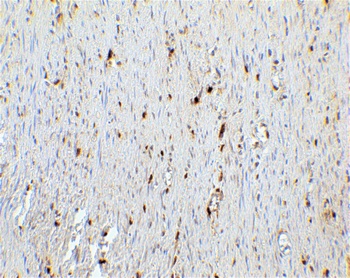 CDKN2A/p16INK4a Antibody