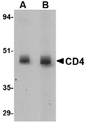 CD4 Antibody