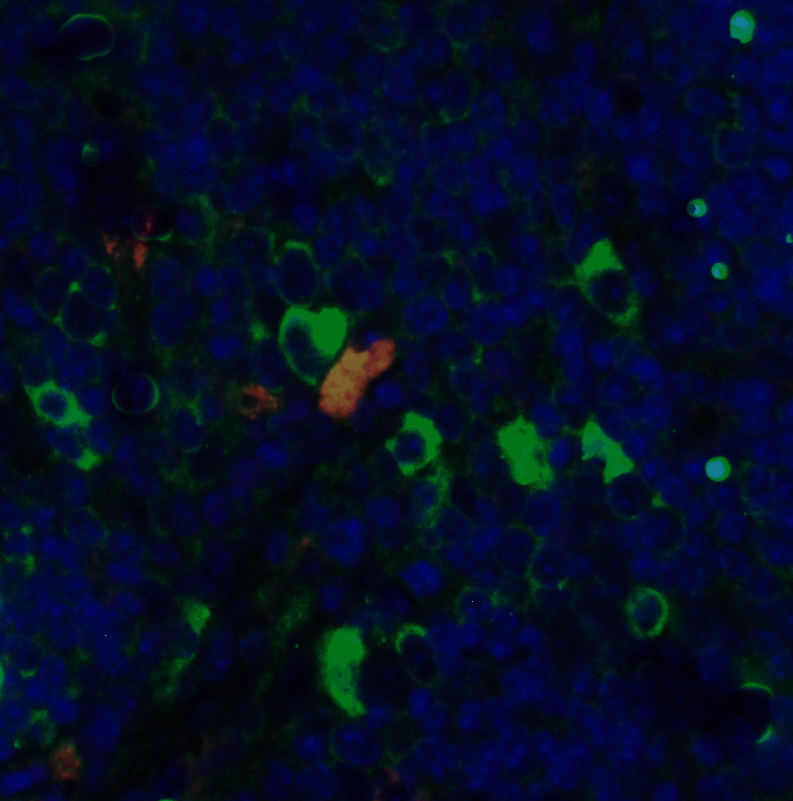 CD4 Antibody