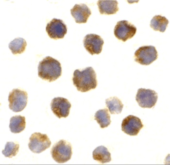 BCL2 Antibody