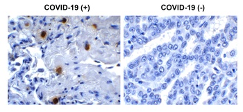 Non-structural protein 10 Antibody