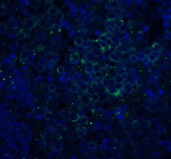 APP Antibody