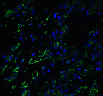 ACE2 Antibody