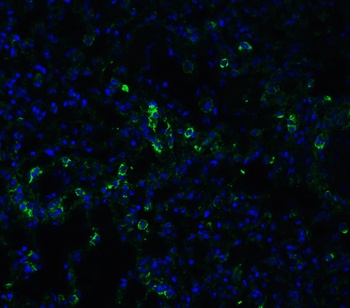 ACE2 Antibody