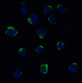 ADAM10 Antibody