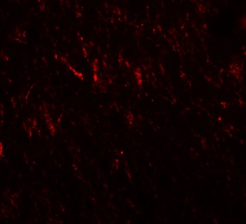 PRICKLE2 Antibody