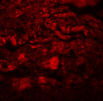 PPAPDC3 Antibody
