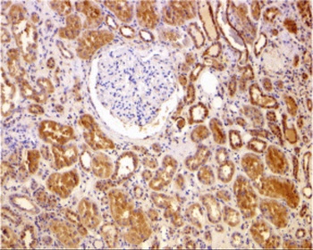 BCL2 Antibody