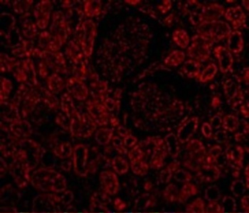 BCL2 Antibody