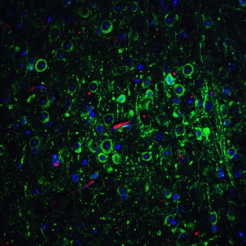 BCL2 Antibody