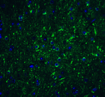 BECN1 Antibody
