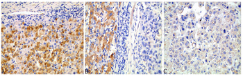 BECN1 Antibody