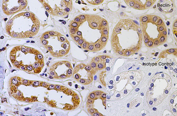 BECN1 Antibody