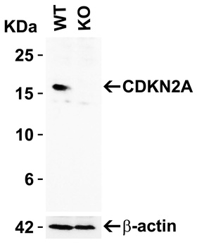 CDKN2A/p16INK4a Antibody
