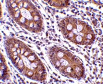 CDKN2A/p16INK4a Antibody