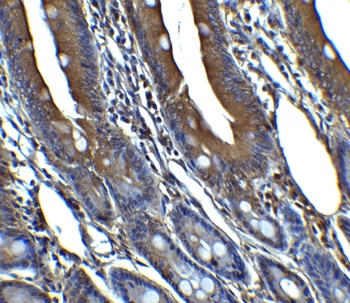 CDKN2A/p16INK4a Antibody