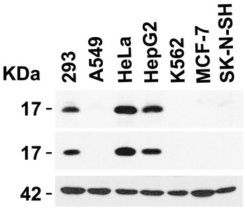 CDKN2A/p16INK4a Antibody