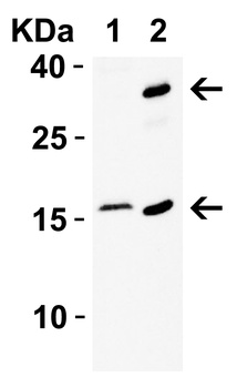 CDKN2A/p16INK4a Antibody